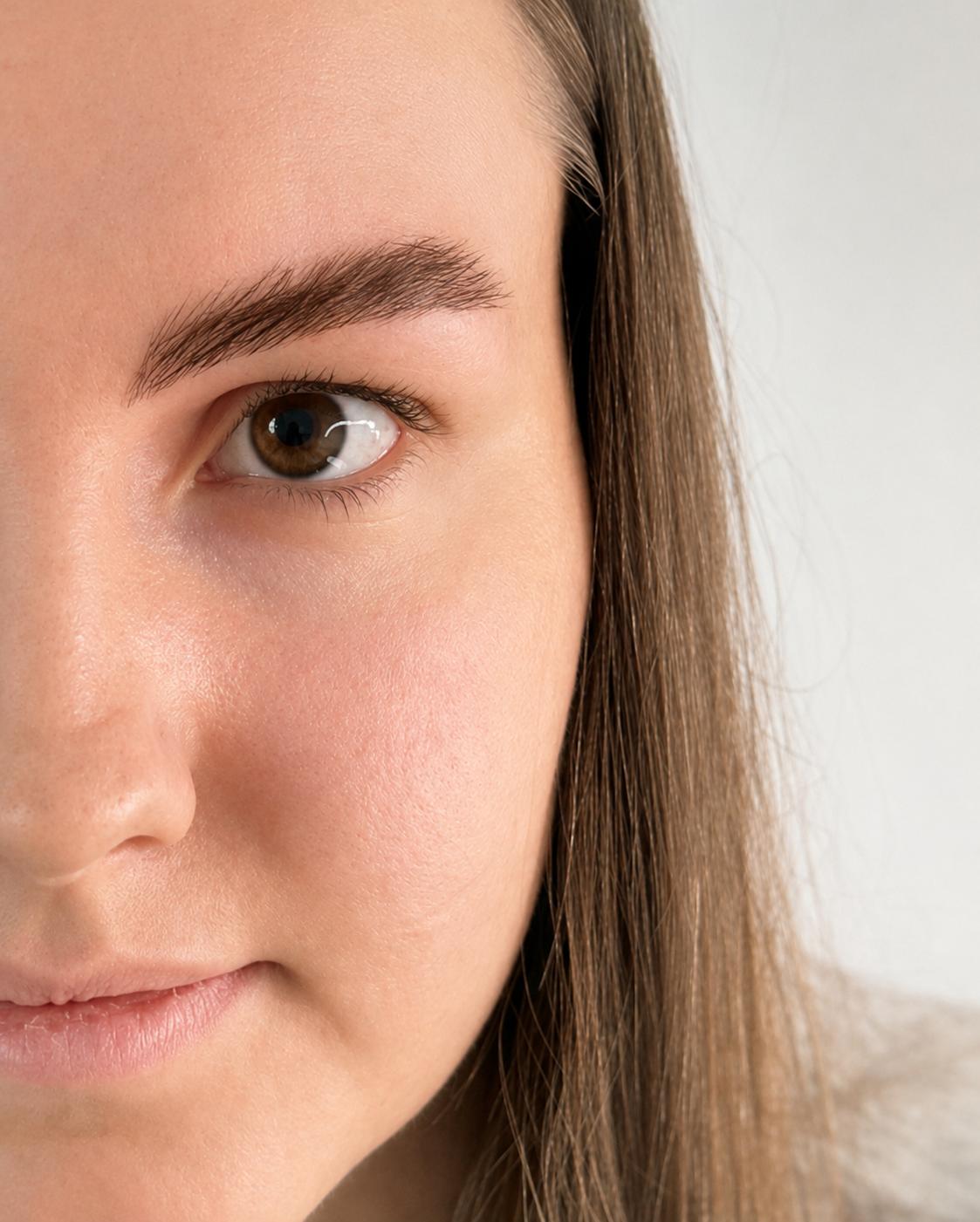 Nachher: Ergebnis nach Lippen Pigmentierung