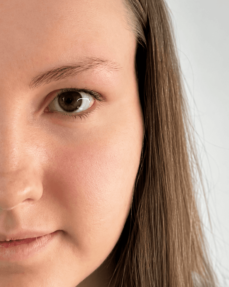 Vorher: Zustand ohne Lippen Pigmentierung